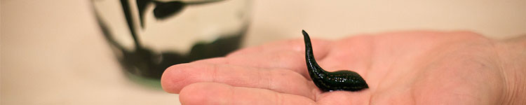 Гирудотерапия на м. Красные Ворота